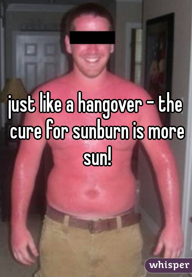 just like a hangover - the cure for sunburn is more sun!