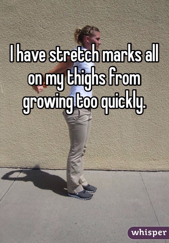 I have stretch marks all on my thighs from growing too quickly. 