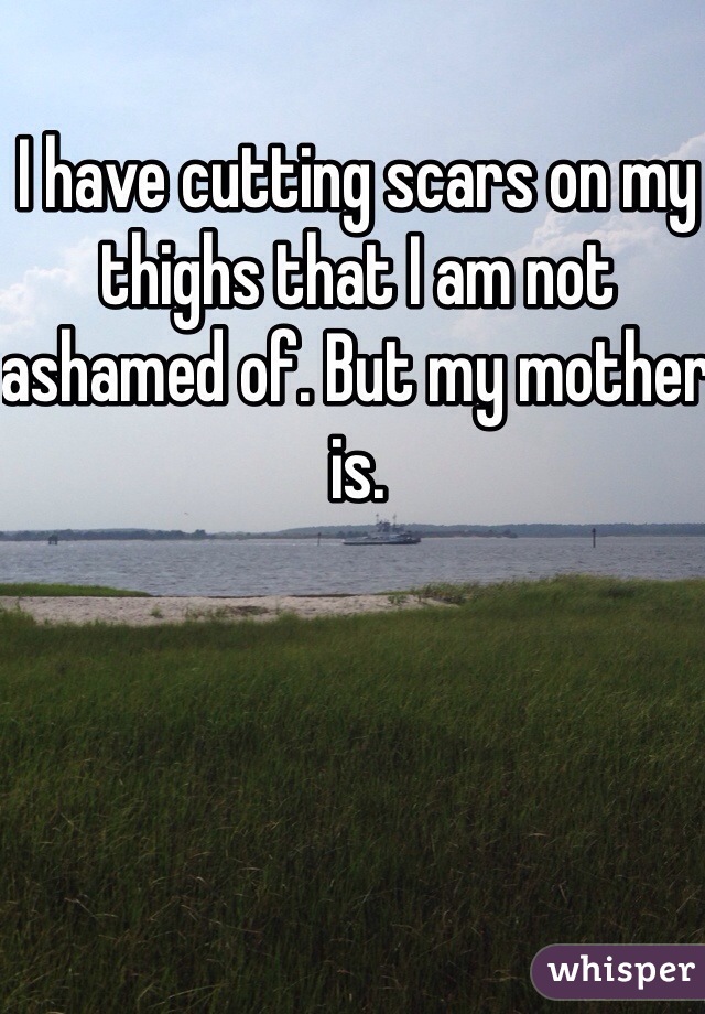 I have cutting scars on my thighs that I am not ashamed of. But my mother is. 