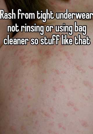 Rash from tight underwear not rinsing or using bag cleaner so stuff like  that