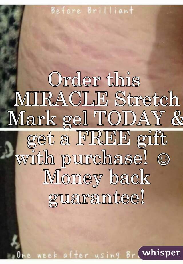 Order this MIRACLE Stretch Mark gel TODAY & get a FREE gift with purchase! ☺  Money back guarantee!
