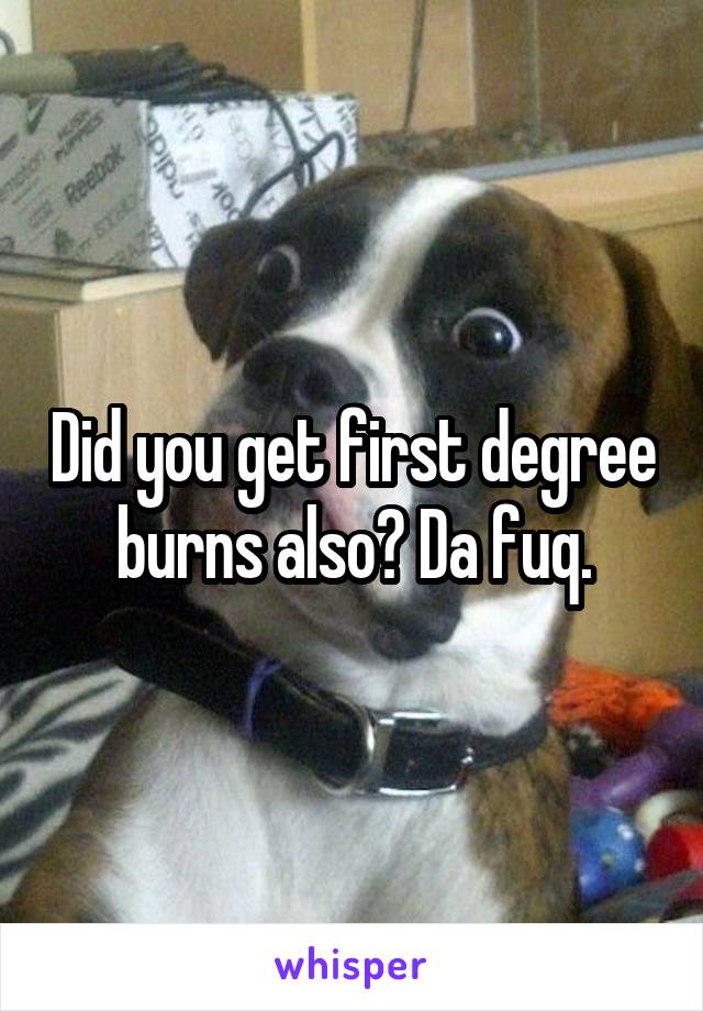 Did you get first degree burns also? Da fuq.