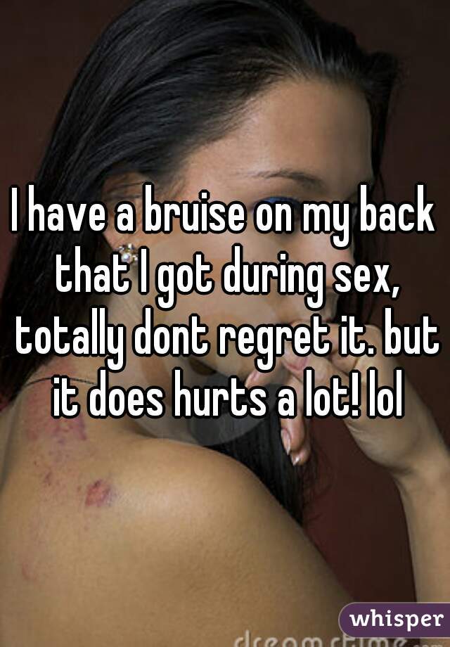 I have a bruise on my back that I got during sex, totally dont regret it. but it does hurts a lot! lol