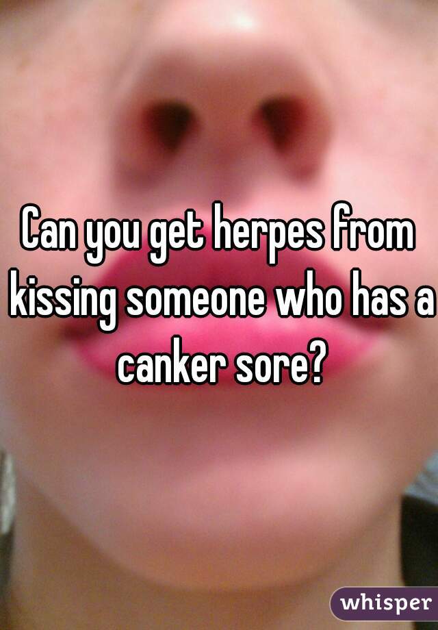 Can you get herpes from kissing someone who has a canker sore?