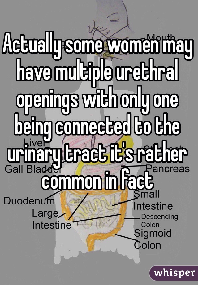 Actually some women may have multiple urethral openings with only one being connected to the urinary tract it's rather common in fact 