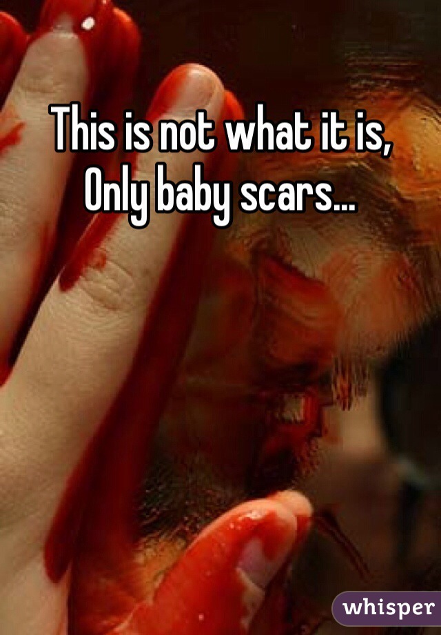 This is not what it is, 
Only baby scars...