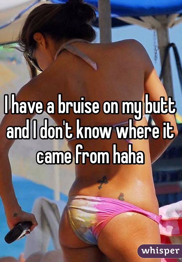 I have a bruise on my butt and I don't know where it came from haha