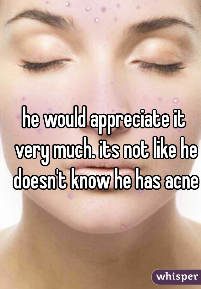 he would appreciate it very much. its not like he doesn't know he has acne