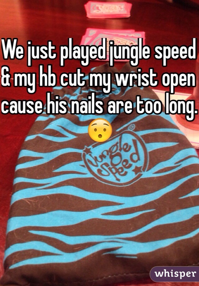 We just played jungle speed & my hb cut my wrist open cause his nails are too long. 😯