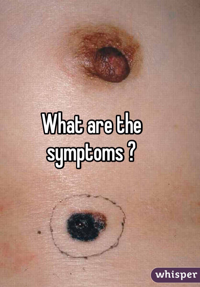 What are the symptoms ?