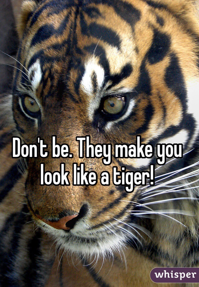 Don't be. They make you look like a tiger!