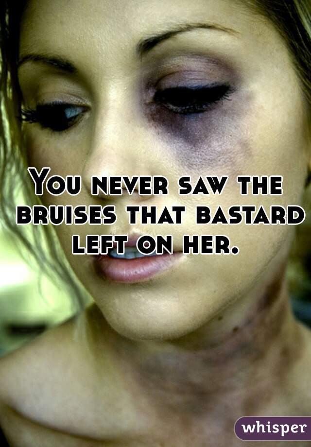 You never saw the bruises that bastard left on her. 