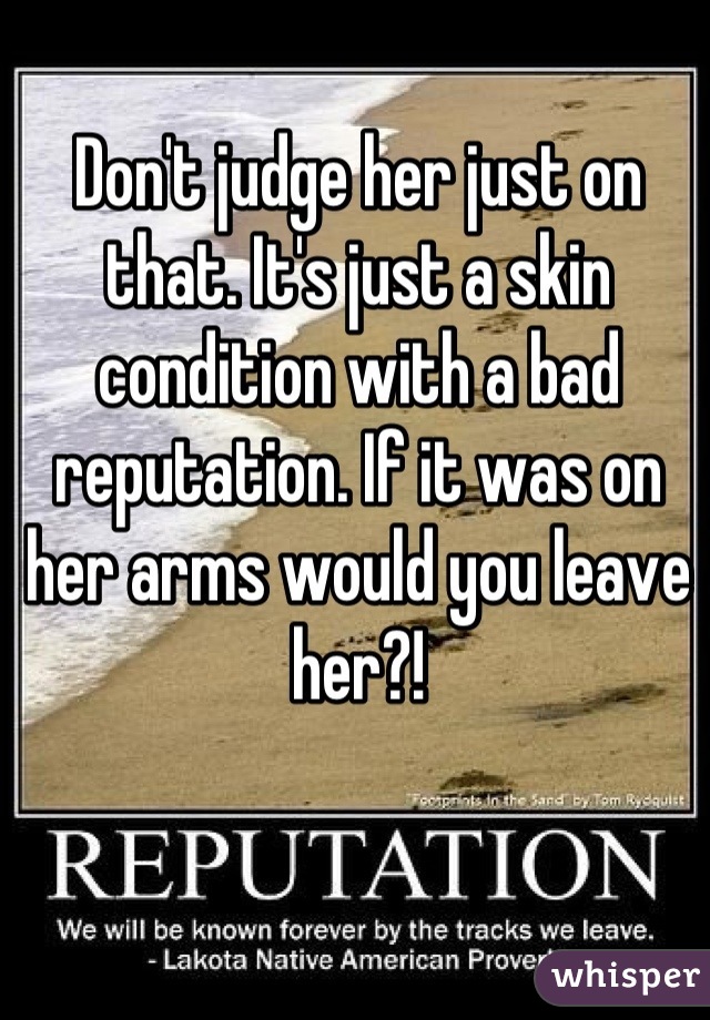 Don't judge her just on that. It's just a skin condition with a bad reputation. If it was on her arms would you leave her?!