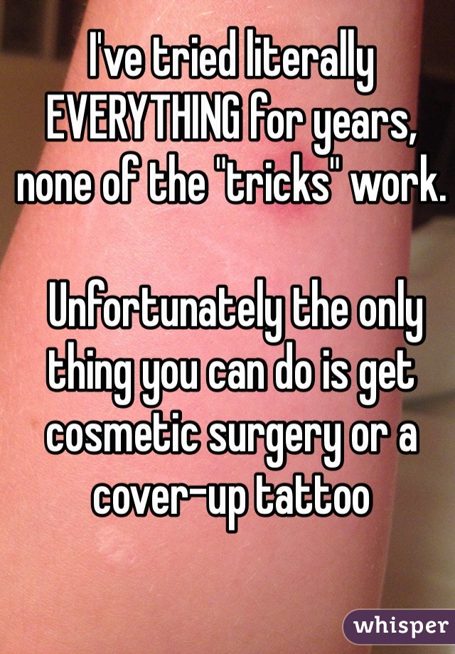 I've tried literally EVERYTHING for years, none of the "tricks" work.

 Unfortunately the only thing you can do is get cosmetic surgery or a cover-up tattoo