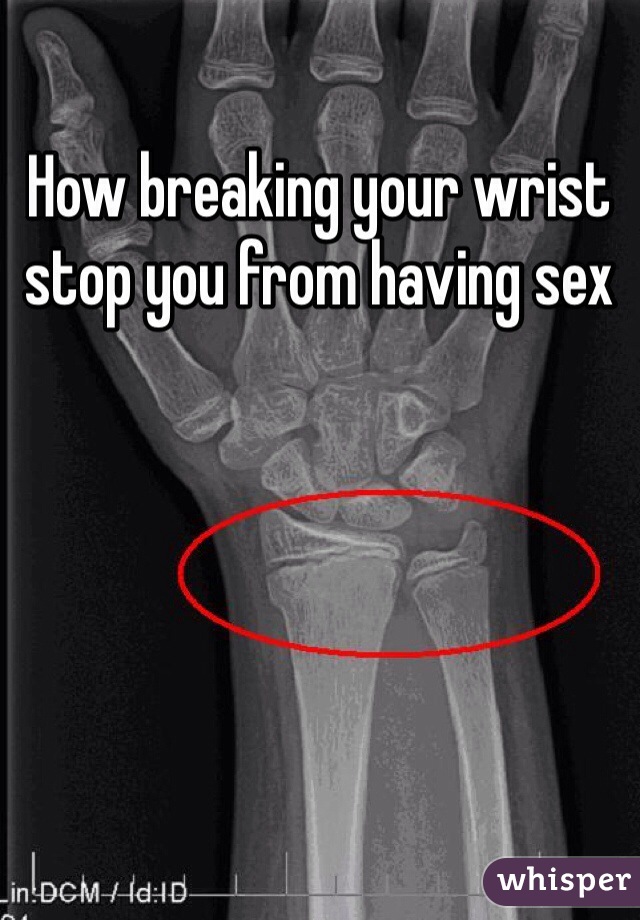 How breaking your wrist stop you from having sex
