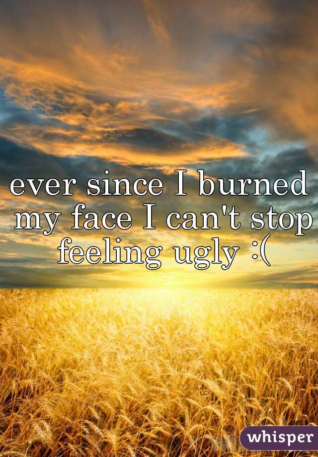 ever since I burned my face I can't stop feeling ugly :(