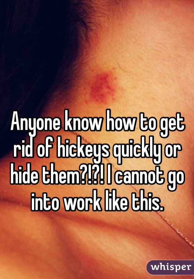 Anyone know how to get rid of hickeys quickly or hide them?!?! I cannot go into work like this.