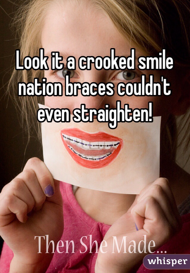 Look it a crooked smile nation braces couldn't even straighten!