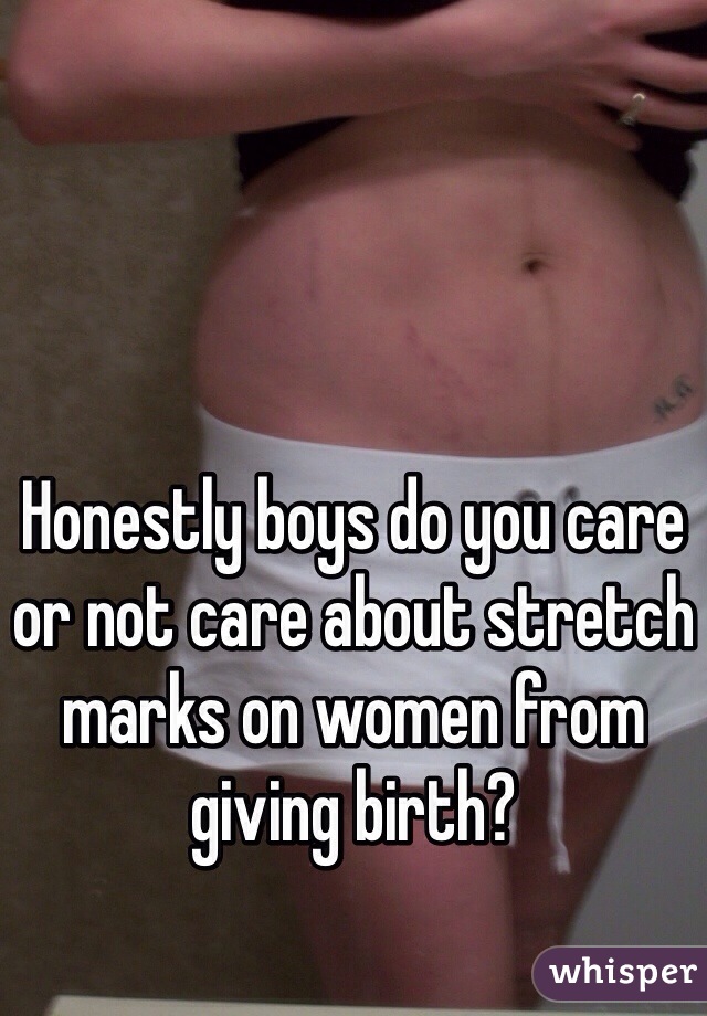 Honestly boys do you care or not care about stretch marks on women from giving birth? 