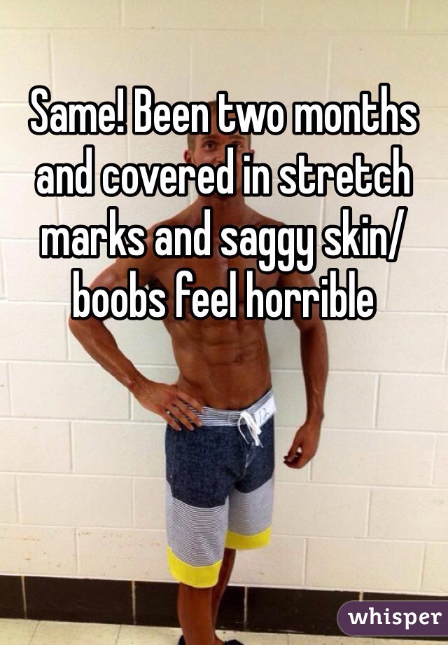 Same! Been two months and covered in stretch marks and saggy skin/boobs feel horrible 
