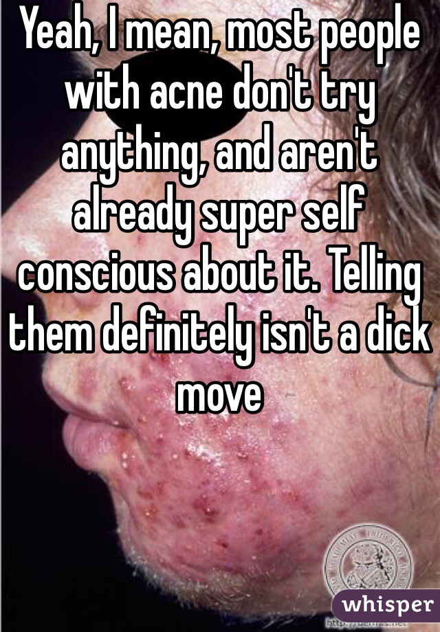 Yeah, I mean, most people with acne don't try anything, and aren't already super self conscious about it. Telling them definitely isn't a dick move