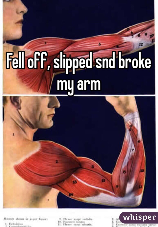 Fell off, slipped snd broke my arm