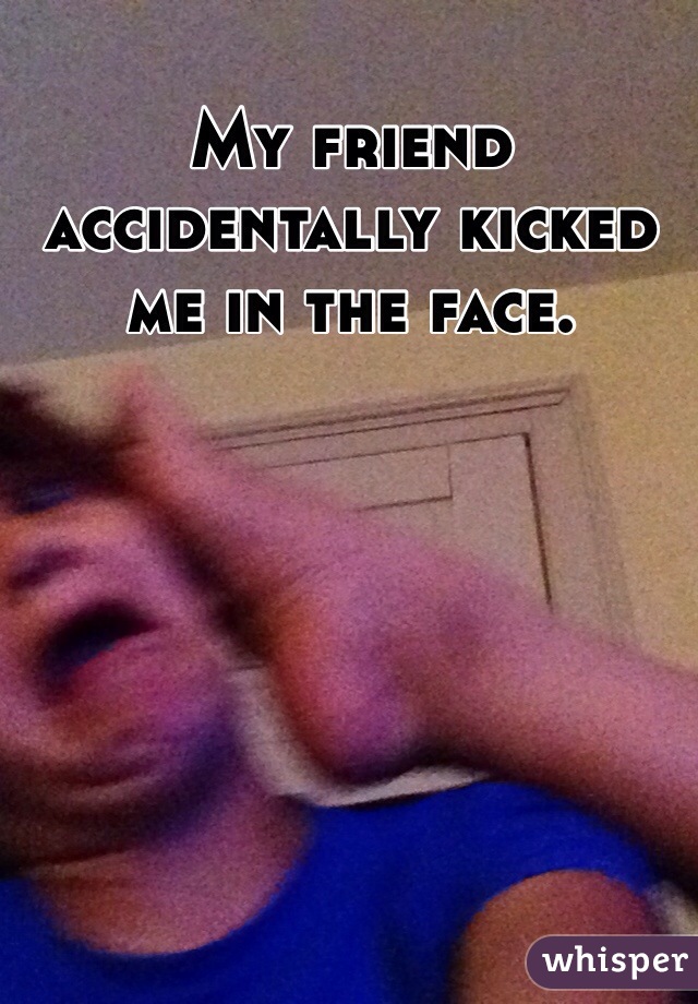 My friend accidentally kicked me in the face.