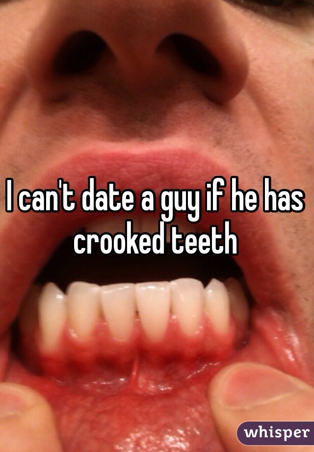 I can't date a guy if he has crooked teeth