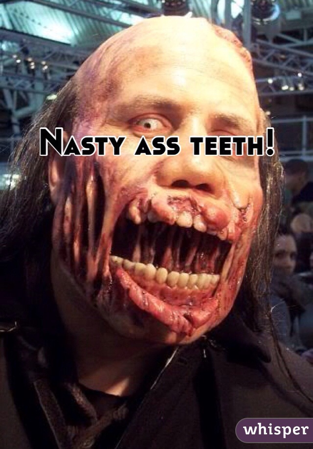Nasty ass teeth!  