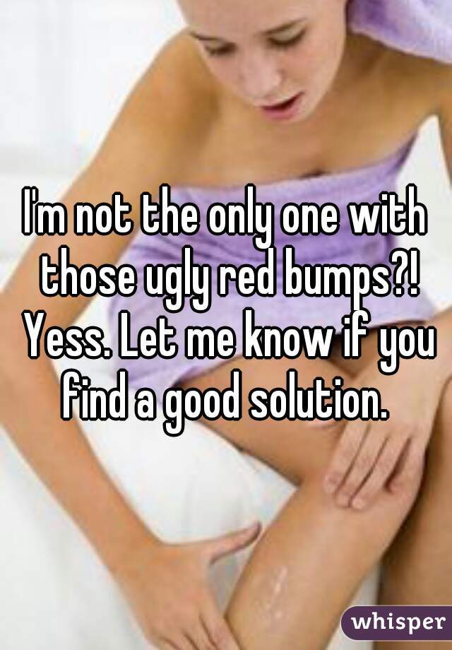 I'm not the only one with those ugly red bumps?! Yess. Let me know if you find a good solution. 