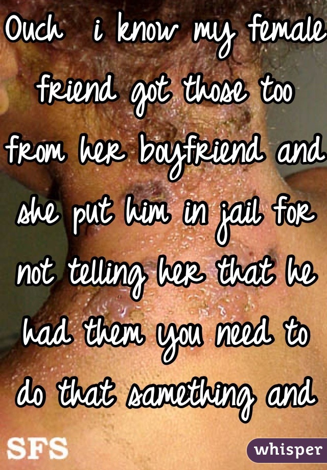 Ouch  i know my female friend got those too from her boyfriend and she put him in jail for not telling her that he had them you need to do that samething and it sucks i heard that herpes is for ever  