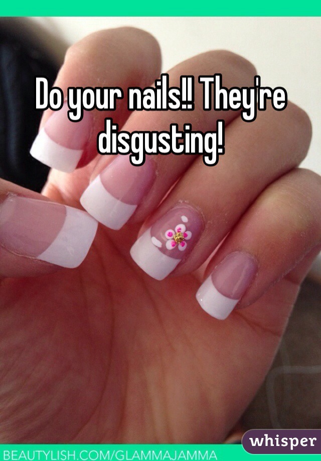 Do your nails!! They're disgusting!