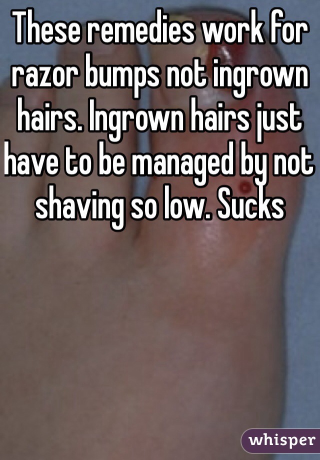 These remedies work for razor bumps not ingrown hairs. Ingrown hairs just have to be managed by not shaving so low. Sucks
