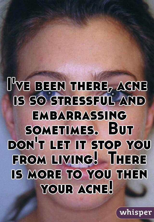 I've been there, acne is so stressful and embarrassing sometimes.  But don't let it stop you from living!  There is more to you then your acne! 