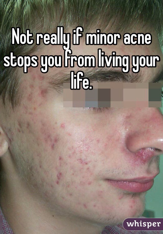 Not really if minor acne stops you from living your life. 