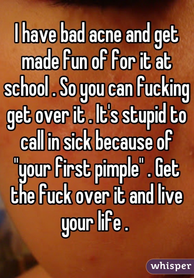I have bad acne and get made fun of for it at school . So you can fucking get over it . It's stupid to call in sick because of "your first pimple" . Get the fuck over it and live your life . 