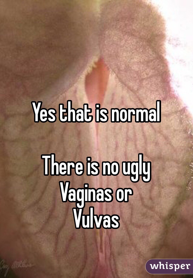 Yes that is normal 

There is no ugly
Vaginas or
Vulvas