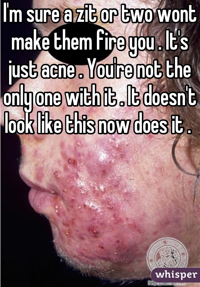 I'm sure a zit or two wont make them fire you . It's just acne . You're not the only one with it . It doesn't look like this now does it . 