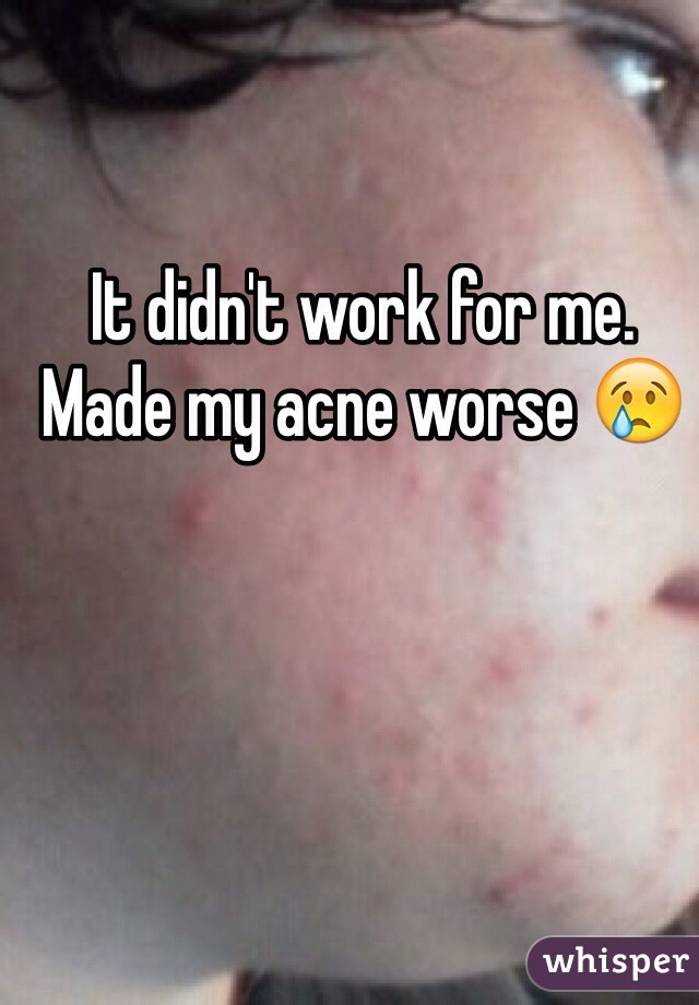It didn't work for me. Made my acne worse 😢