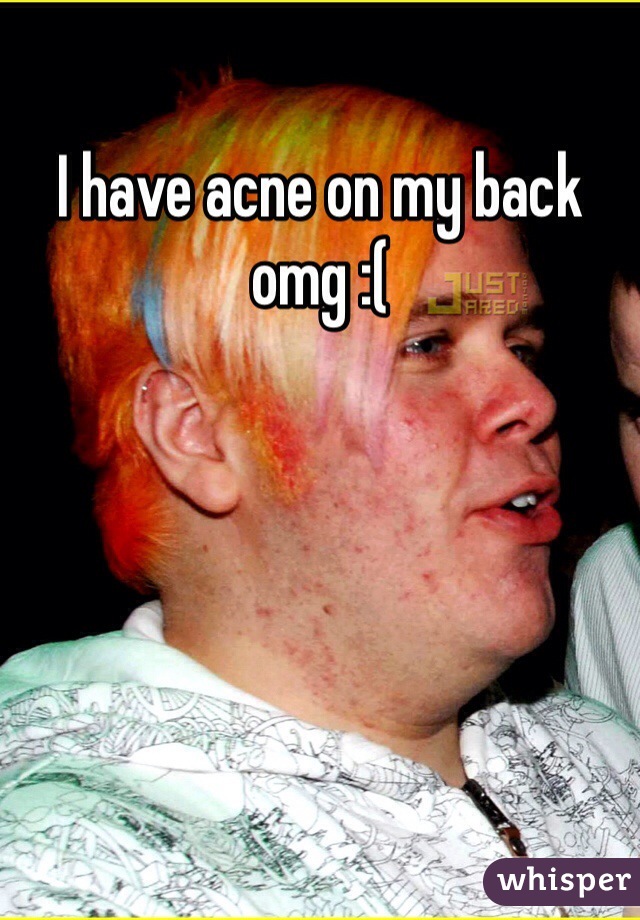 I have acne on my back omg :(