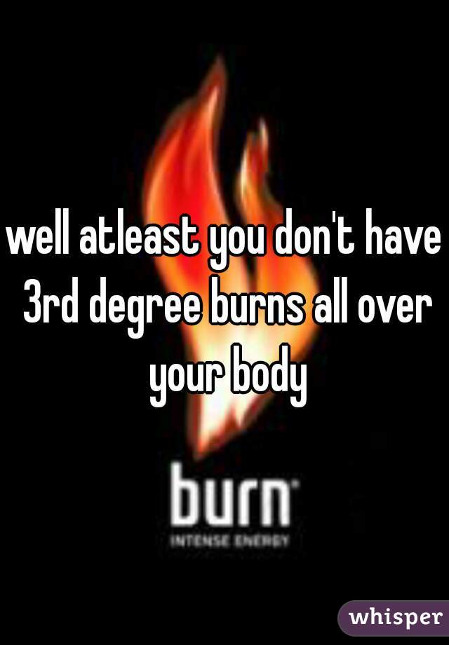 well atleast you don't have 3rd degree burns all over your body
