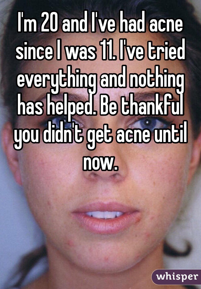 I'm 20 and I've had acne since I was 11. I've tried everything and nothing has helped. Be thankful you didn't get acne until now. 
