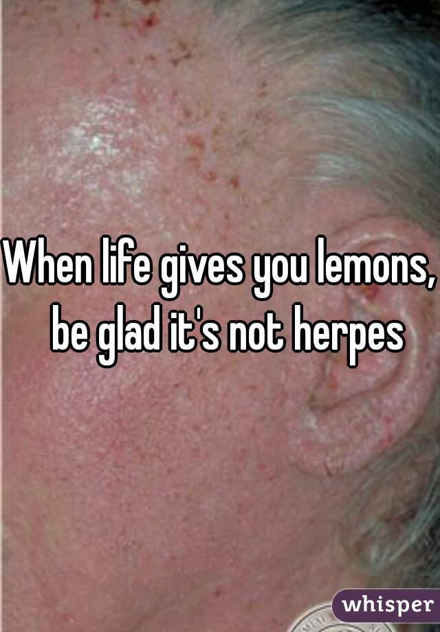 When life gives you lemons,  be glad it's not herpes