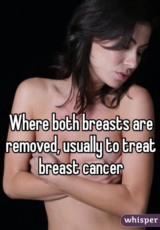 Where both breasts are removed, usually to treat breast cancer 
