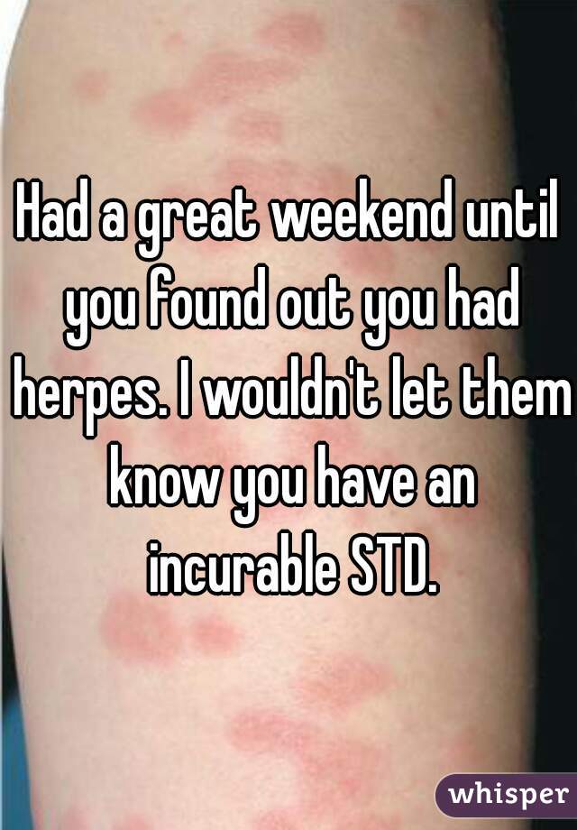 Had a great weekend until you found out you had herpes. I wouldn't let them know you have an incurable STD.
