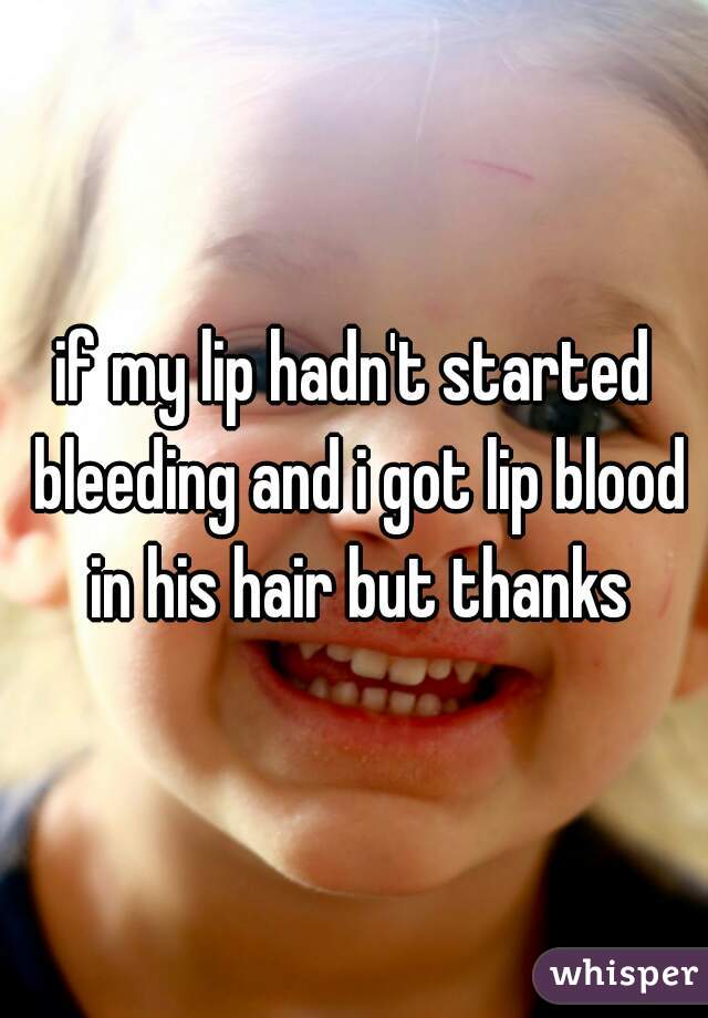 if my lip hadn't started bleeding and i got lip blood in his hair but thanks