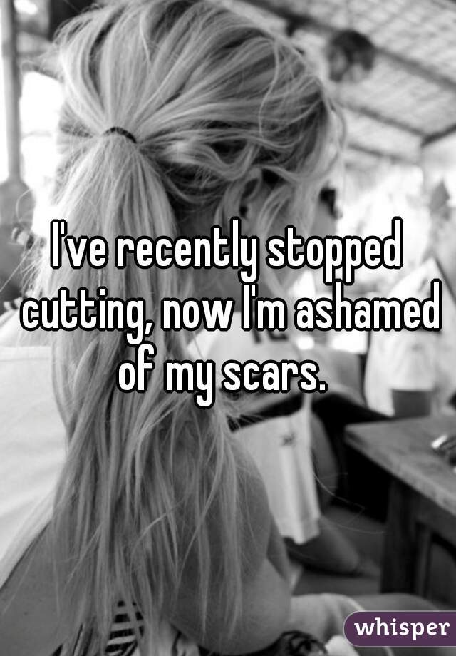 I've recently stopped cutting, now I'm ashamed of my scars.  