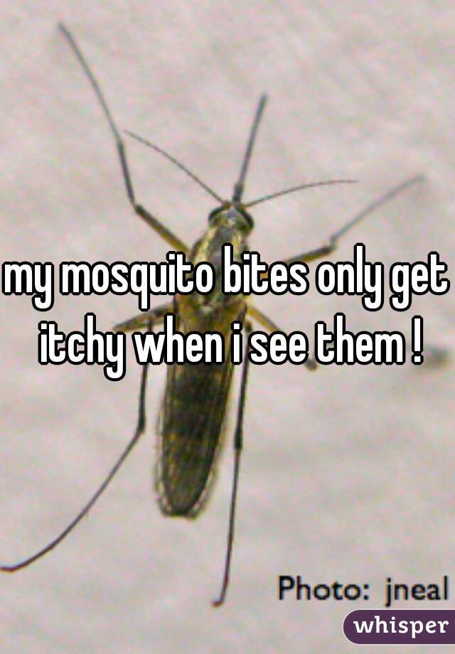 my mosquito bites only get itchy when i see them !