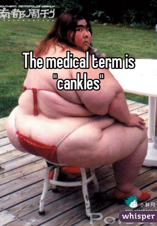 The medical term is "cankles"