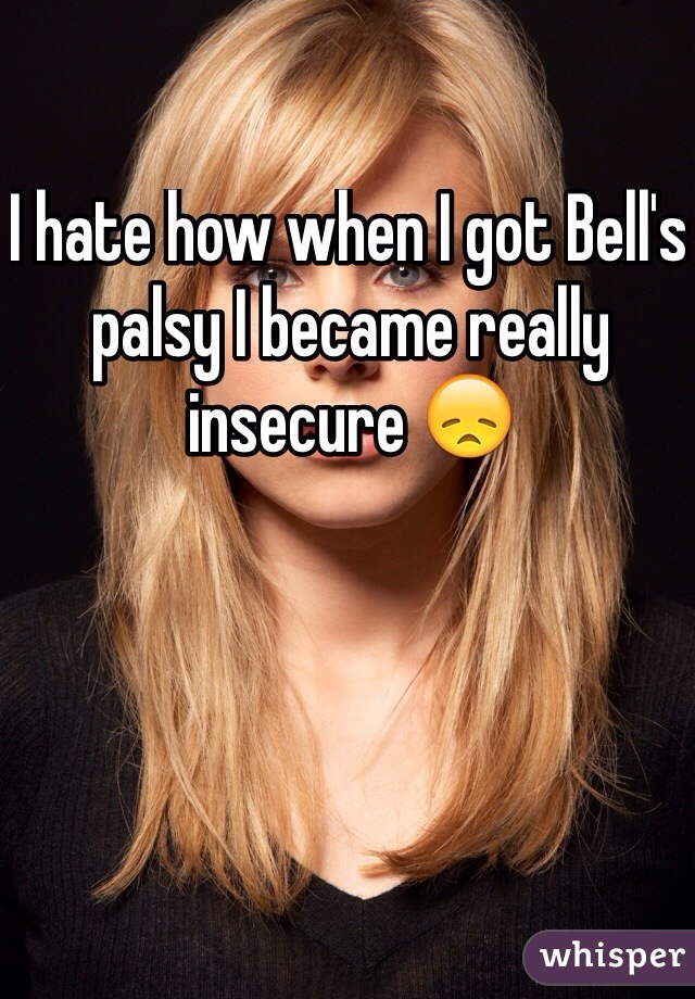 I hate how when I got Bell's palsy I became really insecure 😞